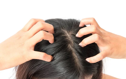 Scratch No More: 7 Best Treatments for Your Itchy Scalp